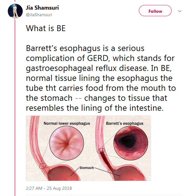 Lepas 10 Tahun Suka Sangat Makan Pedas & Lambat Makan 