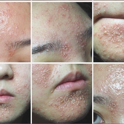 TAKUTNYA Bahaya Petua Cantik 'HOMEMADE', DOKTOR Kata Boleh 